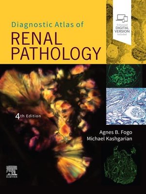 cover image of Diagnostic Atlas of Renal Pathology E-Book